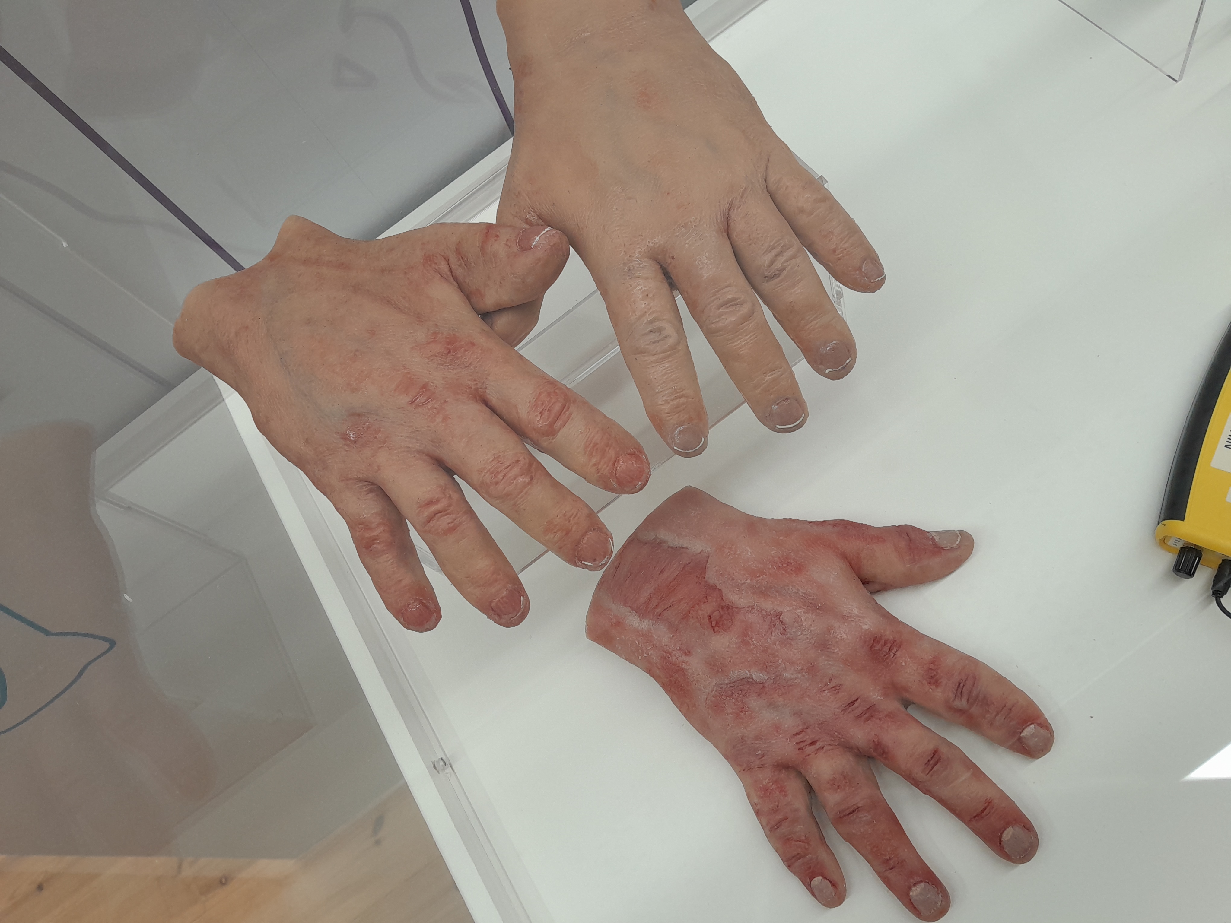 Umbraco.Web.PublishedCache.XmlPublishedCache.XmlPublishedProperty