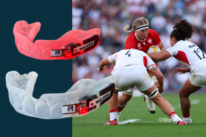 Smart mouthguards in rugby