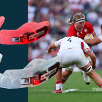 Smart mouthguards in rugby